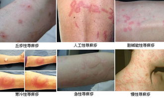 兰州北大皮肤科