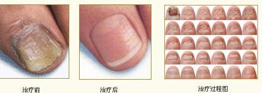 兰州北大皮肤科